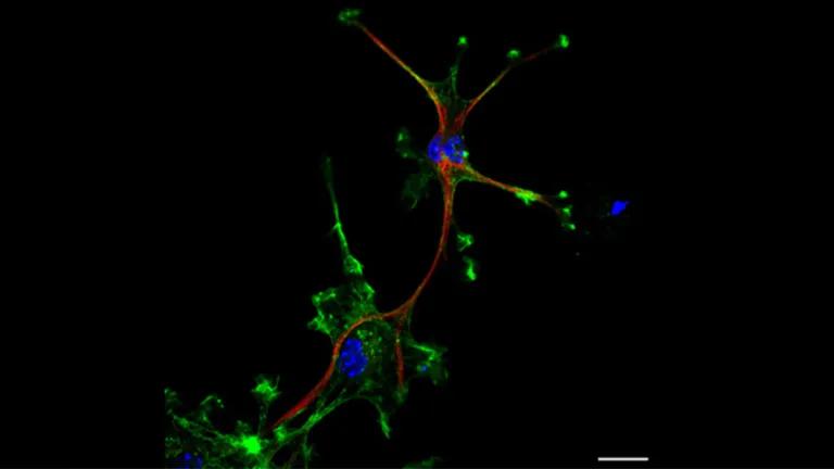 Green GBM cells and one green and red cell mimicking an astrocyte