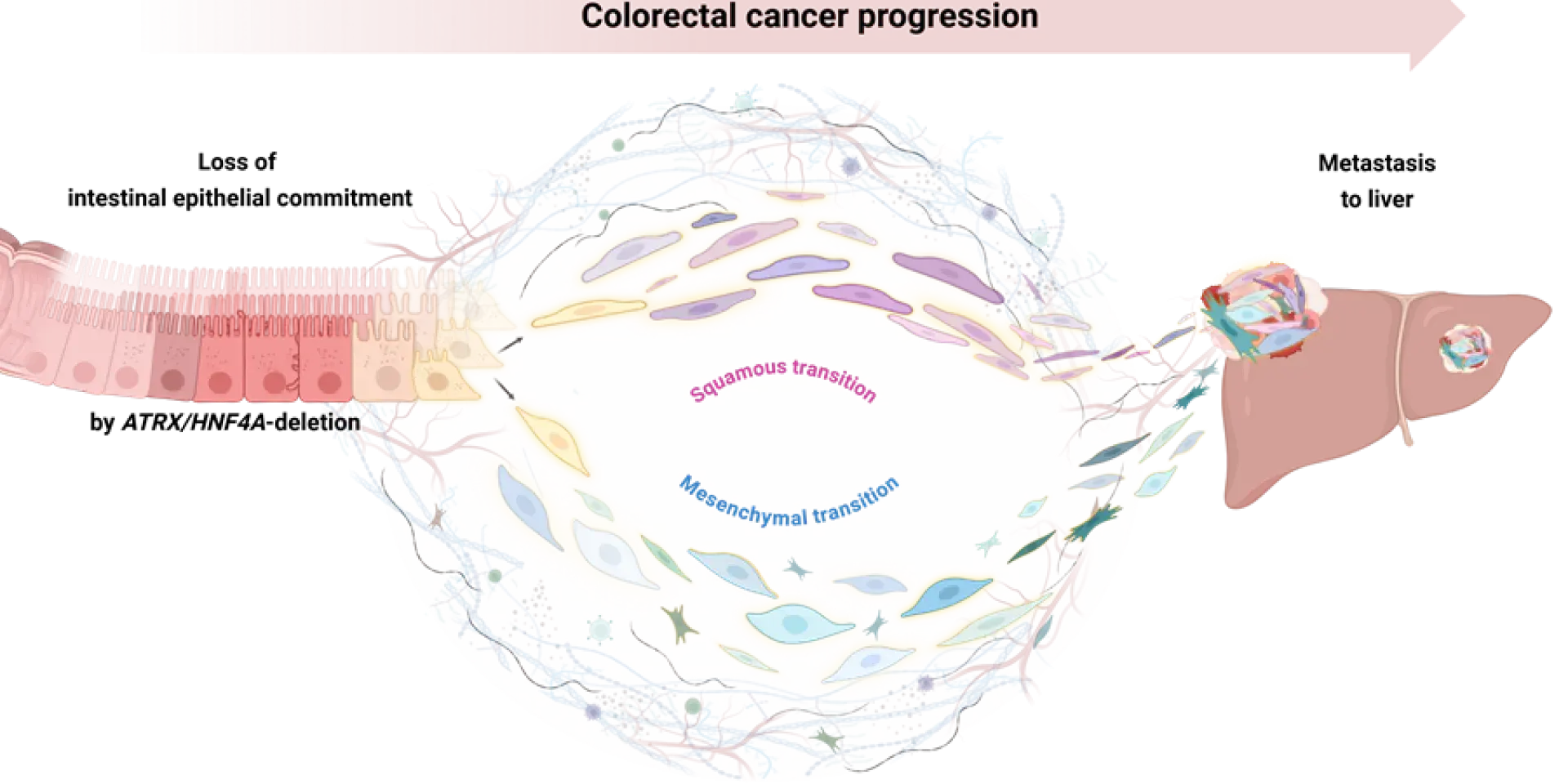 Bowel cancer cells on the left of the diagram, with a rectangular shape, go through the “shapeshifting” process known as squamous/ mesenchymal transition and emerge with a different appearance akin to skin or muscle cells