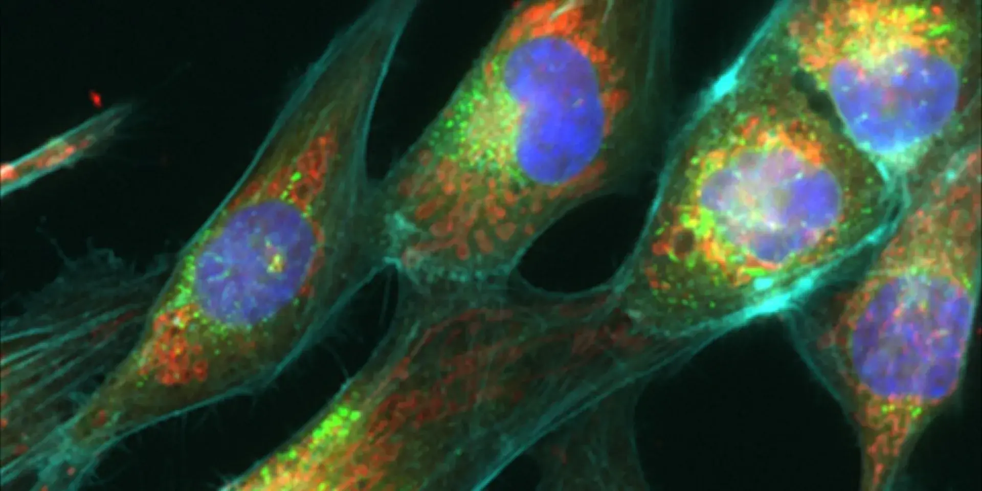 A confocal image of some cancer cells