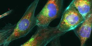 A confocal image of some cancer cells