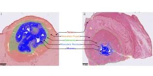Abstract from Crohn's paper