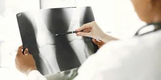 Doctor examining x-ray