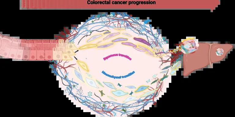 Bowel cancer cells on the left of the diagram, with a rectangular shape, go through the “shapeshifting” process known as squamous/ mesenchymal transition and emerge with a different appearance akin to skin or muscle cells