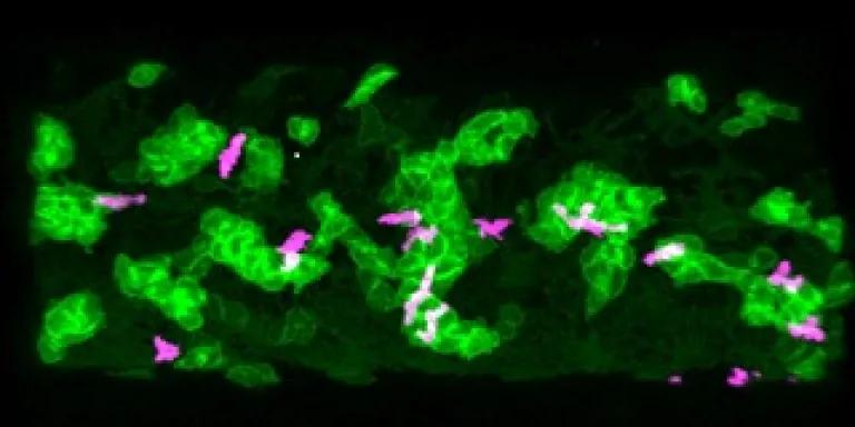Neutrophils