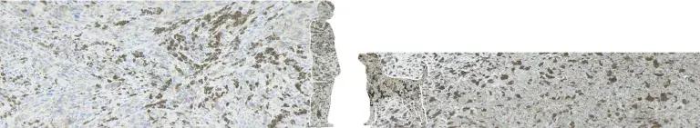Skin cancer human and canine