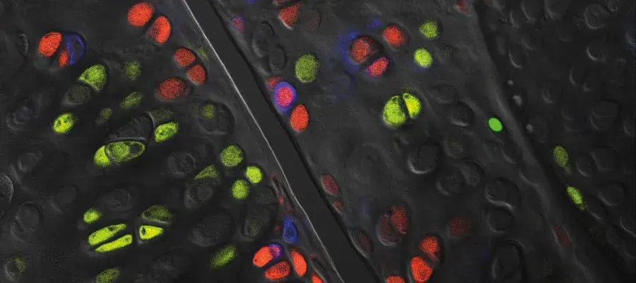 Anke Roelofs Research Image