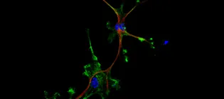 Green GBM cells and one green and red cell mimicking an astrocyte
