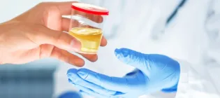 Urine sample being handed to a clinician