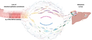 Bowel cancer cells on the left of the diagram, with a rectangular shape, go through the “shapeshifting” process known as squamous/ mesenchymal transition and emerge with a different appearance akin to skin or muscle cells