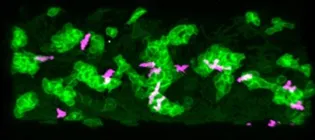 Neutrophils