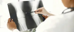 Doctor examining x-ray