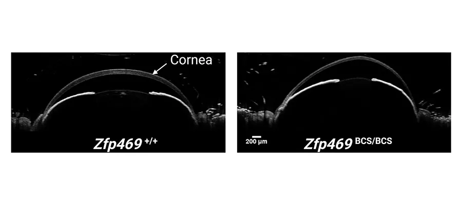 Mouse model lends insights into genetic eye condition: News 9.2021