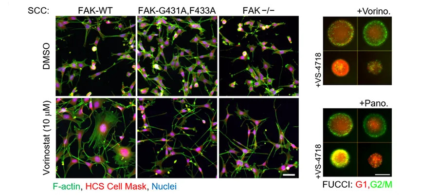 FAK and HDAC synergy