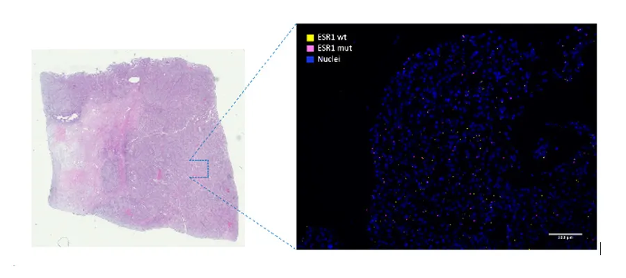 Genomic and Response Directed Assay & In-Situ Mutation Detection diagram