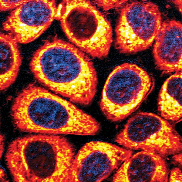 V.Brunton - Research Programme 3