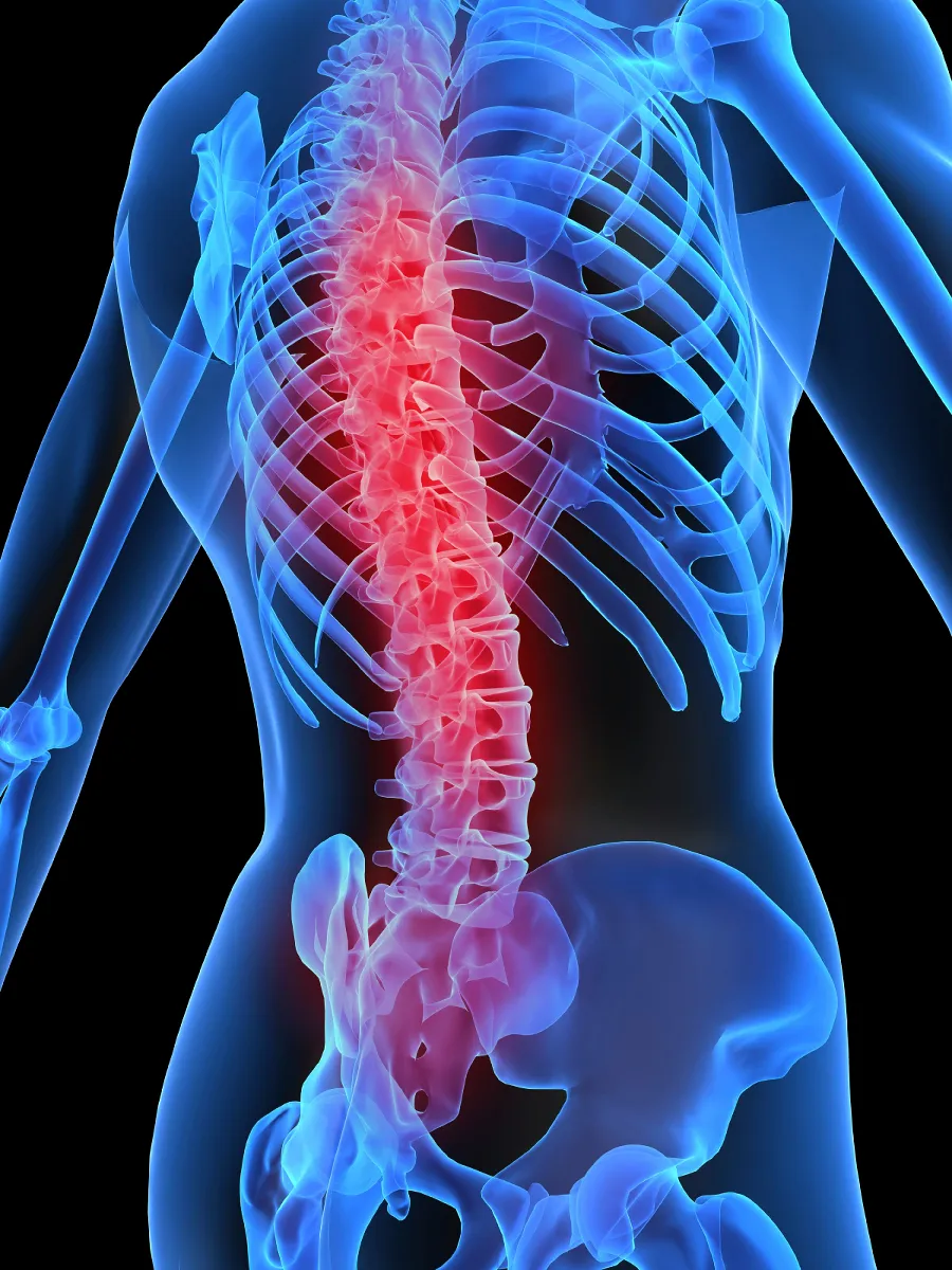 Image of spine