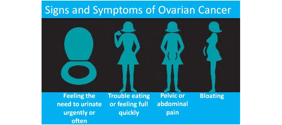 Signs and symptoms of ovarian cancer. 