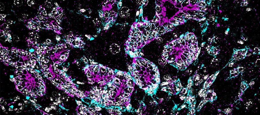 Vangl2 in ducts magenta and cyan