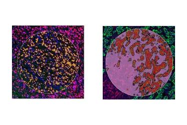 Example of possible segmentation strategies