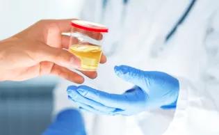 Urine sample being handed to a clinician
