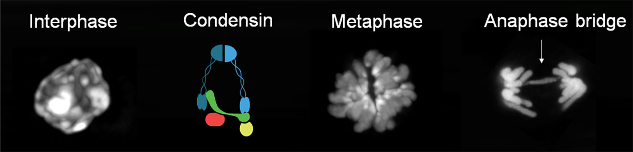 Condensin