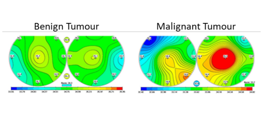 Microwave Radiometry and Cancer Imaging Diagram